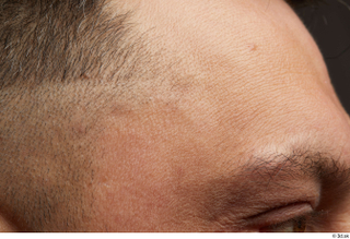 HD Face Skin Kyle Riley face forehead hair skin pores…